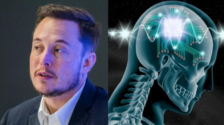 Neuralink nedir Çılgın proje Neuralink ne demek Elon Muskın çok konuşulan projesi Neuralink hakkında bilgiler