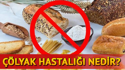 Çölyak hastalığı nedir, belirtileri nelerdir Çölyak hastalığı tedavisi ve diyetiyle ilgili bilgiler