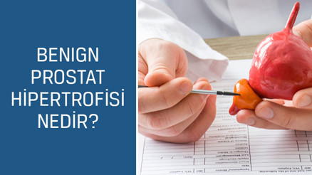 Üroloji Uzmanı Doç. Dr. Mustafa Kıraç cevaplıyor; Benign prostat hipertrofisi nedir, belirtileri ve tedavisi nasıldır
