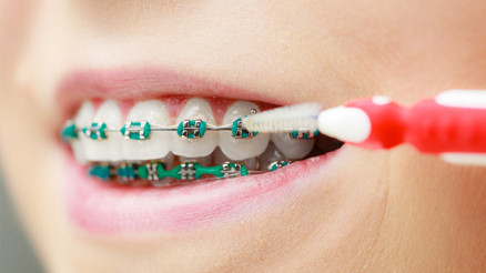 Ortodontik tedavi için diş hekimime gidebilir miyim