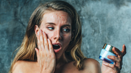 İlaç Kullanmadan Sivilce İzleri Nasıl Geçer