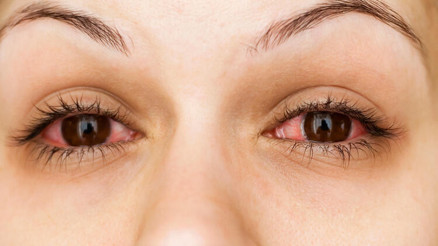 Uzman isim açıkladı: Koronavirüs belirtileri gözlerde de görülebiliyor