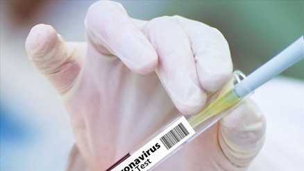 Üç dakikada sonuç veren koronavirüs testi geliştirildi