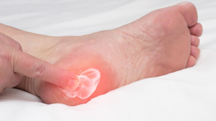 Topuk Dikeni Neden Olur ve Nasıl Geçer