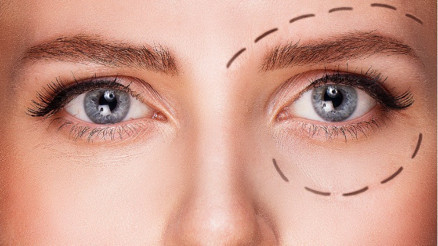 Göz Çevresi Estetiği Nasıl Yapılır