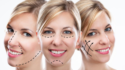 Kombine yüz estetiği operasyonları