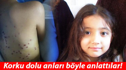 Küçük Berra, 100 saçmayla yaralanmıştı Magandalar hakkında karar