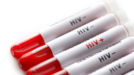 AIDS hayatımızın içinde... Korunmak için neler yapılabilir AIDS hayatımızın içinde... Korunmak için neler yapılabilir