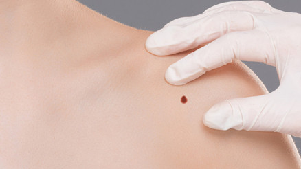 Yeni çıkan benler mutlaka takip edilmeli