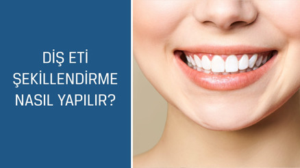 Diş Hekimi ve Protez Uzmanı Dr. Esma Sönmez cevaplıyor; Diş eti şekillendirme nasıl yapılır