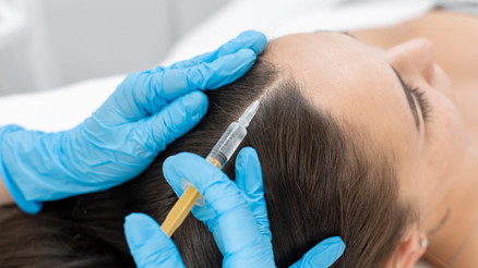 PRP Tedavisi ile Dökülen Saçlar Geri Kazanılır mı