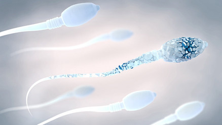 Sperm şekil (morfoloji) bozukluğu nedir Sperm şekil (morfoloji) bozukluğu nedir
