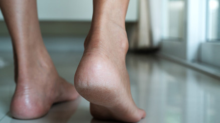 Bu Çareler Mutfağınızda Saklı… Çatlak Topukları Onarmanın 9 Harika Yolu Bu Çareler Mutfağınızda Saklı… Çatlak Topukları Onarmanın 9 Harika Yolu