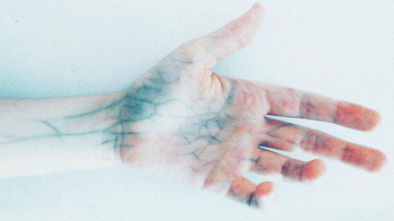 Yeni Lazer Teknolojisi Zümrüt Nedir, Hangi Durumlarda Kullanılır