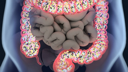 Geçirgen bağırsak sendromu nedir, nasıl ortaya çıkar