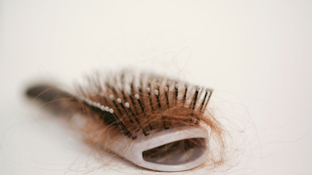 Saç Dökülmesinin Nedenleri ve Tedavi Şekilleri Saç Dökülmesinin Nedenleri ve Tedavi Şekilleri