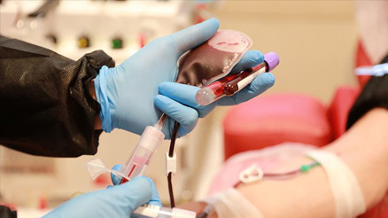 İmmün plazma tedavisi nedir İşte İmmün plazma tedavisinin ayrıntıları İmmün plazma tedavisi nedir İşte İmmün plazma tedavisinin ayrıntıları