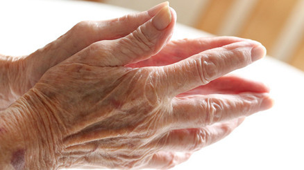 Parkinson Hastalığı Nedir ve Neden Olur Parkinson Hastalığı Nedir ve Neden Olur