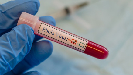 Yeni bir salgın alarmı Ebola virüsü geri mi dönüyor Yeni bir salgın alarmı Ebola virüsü geri mi dönüyor