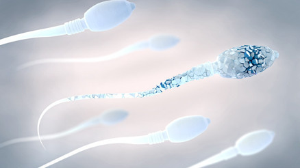 Gebelik kayıpları sperm bozukluğundan kaynaklanabilir Gebelik kayıpları sperm bozukluğundan kaynaklanabilir