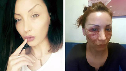 Kuaför salonunda yaptırdığı örümcek ağı hayatını kâbusa çevirdi: Güzel olmak isterken hayatımın 2-3 senesi silindi