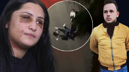 Samsunda eski eşi tarafından darp edilen kadın konuştu