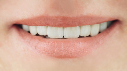 Dokularınızın Dostu: Seramik - Zirkon İmplant