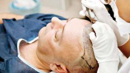 Saç ektirme furyası pandemi dinlemedi Saç ektirme furyası pandemi dinlemedi