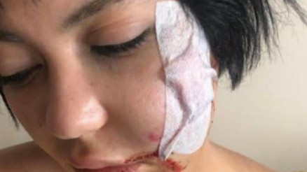 Bahar Candan’ın erkek arkadaşı tarafından darp edildiği iddia edildi - Bahar Candan kimdir Bahar Candan’ın erkek arkadaşı tarafından darp edildiği iddia edildi - Bahar Candan kimdir
