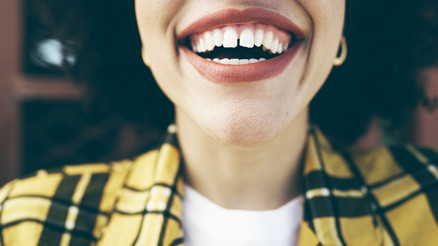 Ayrık Dişler Estetik Kaygı Oluşturuyor