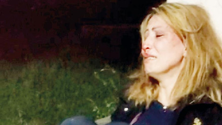 Eşinin öldüresiye dövdüğü İranlı kadın idamdan kaçmış