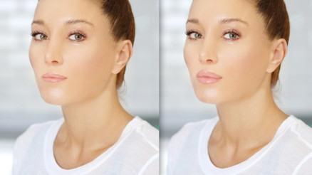 Dudak dolgusunun avantajları Dudak dolgusunun avantajları