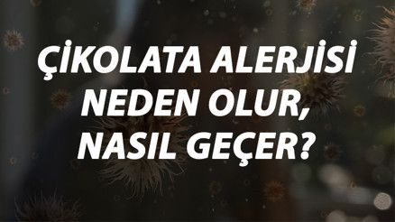 Çikolata Alerjisi Nedir, Neden Olur Ve Nasıl Geçer Çikolata Alerjisi Belirtileri Ve Tedavisi Hakkında Bilgi