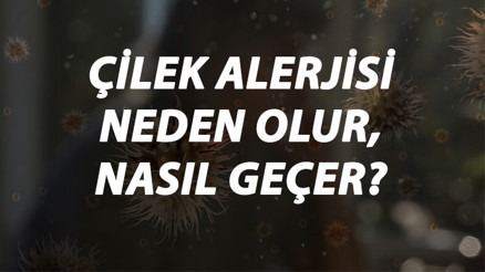 Çilek Alerjisi Nedir, Neden Olur Ve Nasıl Geçer Çilek Alerjisi Belirtileri Ve Tedavisi Hakkında Bilgi