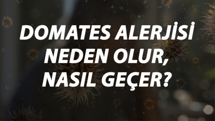 Domates Alerjisi Nedir, Neden Olur Ve Nasıl Geçer Domates Alerjisi Belirtileri Ve Tedavisi Hakkında Bilgi
