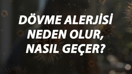 Dövme Alerjisi Nedir, Neden Olur Ve Nasıl Geçer Dövme Alerjisi Belirtileri Ve Tedavisi Hakkında Bilgi