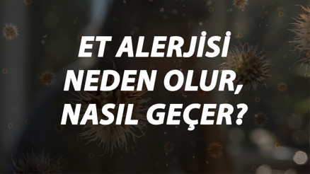 Et Alerjisi Nedir, Neden Olur Ve Nasıl Geçer Et Alerjisi Belirtileri Ve Tedavisi Hakkında Bilgi