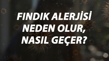 Fındık Alerjisi Nedir, Neden Olur Ve Nasıl Geçer Fındık Alerjisi Belirtileri Ve Tedavisi Hakkında Bilgi