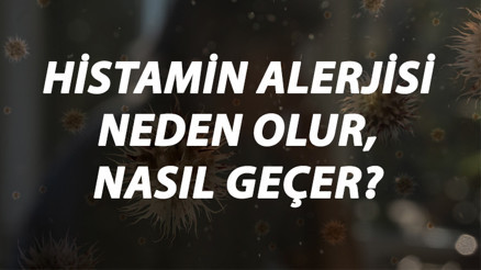 Histamin Alerjisi Nedir, Neden Olur Ve Nasıl Geçer Histamin Alerjisi Belirtileri Ve Tedavisi Hakkında Bilgi
