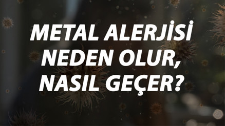 Metal Alerjisi Nedir, Neden Olur Ve Nasıl Geçer Metal Alerjisi Belirtileri Ve Tedavisi Hakkında Bilgi