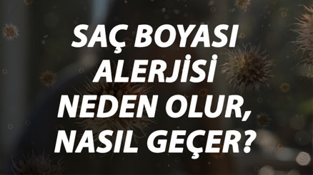 Saç Boyası Alerjisi Nedir, Neden Olur Ve Nasıl Geçer Saç Boyası Alerjisi Belirtileri Ve Tedavisi Hakkında Bilgi Saç Boyası Alerjisi Nedir, Neden Olur Ve Nasıl Geçer Saç Boyası Alerjisi Belirtileri Ve Tedavisi Hakkında Bilgi