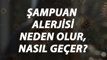 Şampuan Alerjisi Nedir, Neden Olur Ve Nasıl Geçer Şampuan Alerjisi Belirtileri Ve Tedavisi Hakkında Bilgi