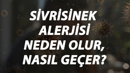 Sivrisinek Alerjisi Nedir, Neden Olur Ve Nasıl Geçer Sivrisinek Isırığı Alerjisi Belirtileri Ve Tedavisi Hakkında Bilgi