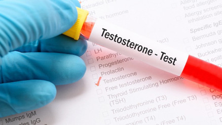 Erkeklik hormonu testosteron
