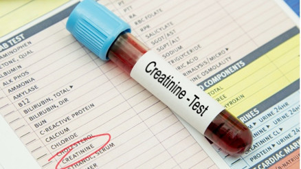 Kreatinin nedir Neden yükselir