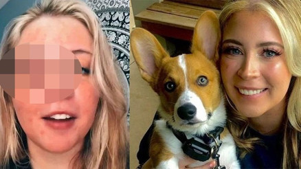 Son dakika: Güzellik salonunda dehşeti yaşadı... Göz kapağını koparttı