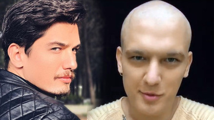 Lenfoma kanseri tedavisi gören Boğaç Aksoy merak edilen soruları cevapladı Lenfoma kanseri tedavisi gören Boğaç Aksoy merak edilen soruları cevapladı