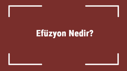 Efüzyon Nedir Kalpte Perikardiyal Ve Plevral Efüzyon Nedir