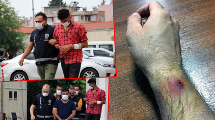 Adanada kumar operasyonu Paraları almak için polisi ısırdı Adanada kumar operasyonu Paraları almak için polisi ısırdı