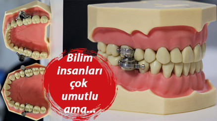 Kilo kontrol cihazına tepki yağıyor... Bunun adı işkence